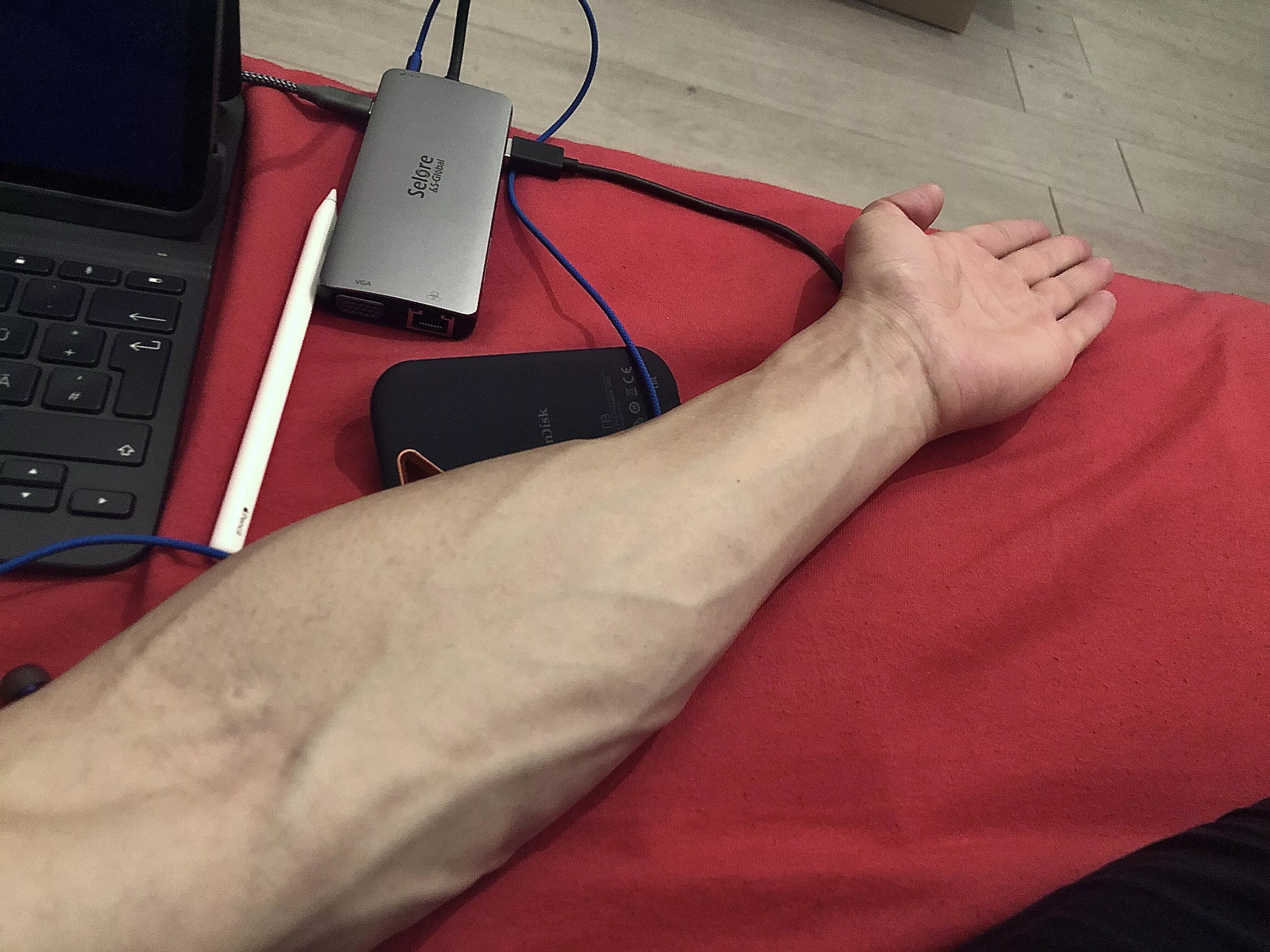 1 AM forearm🙃 Good night