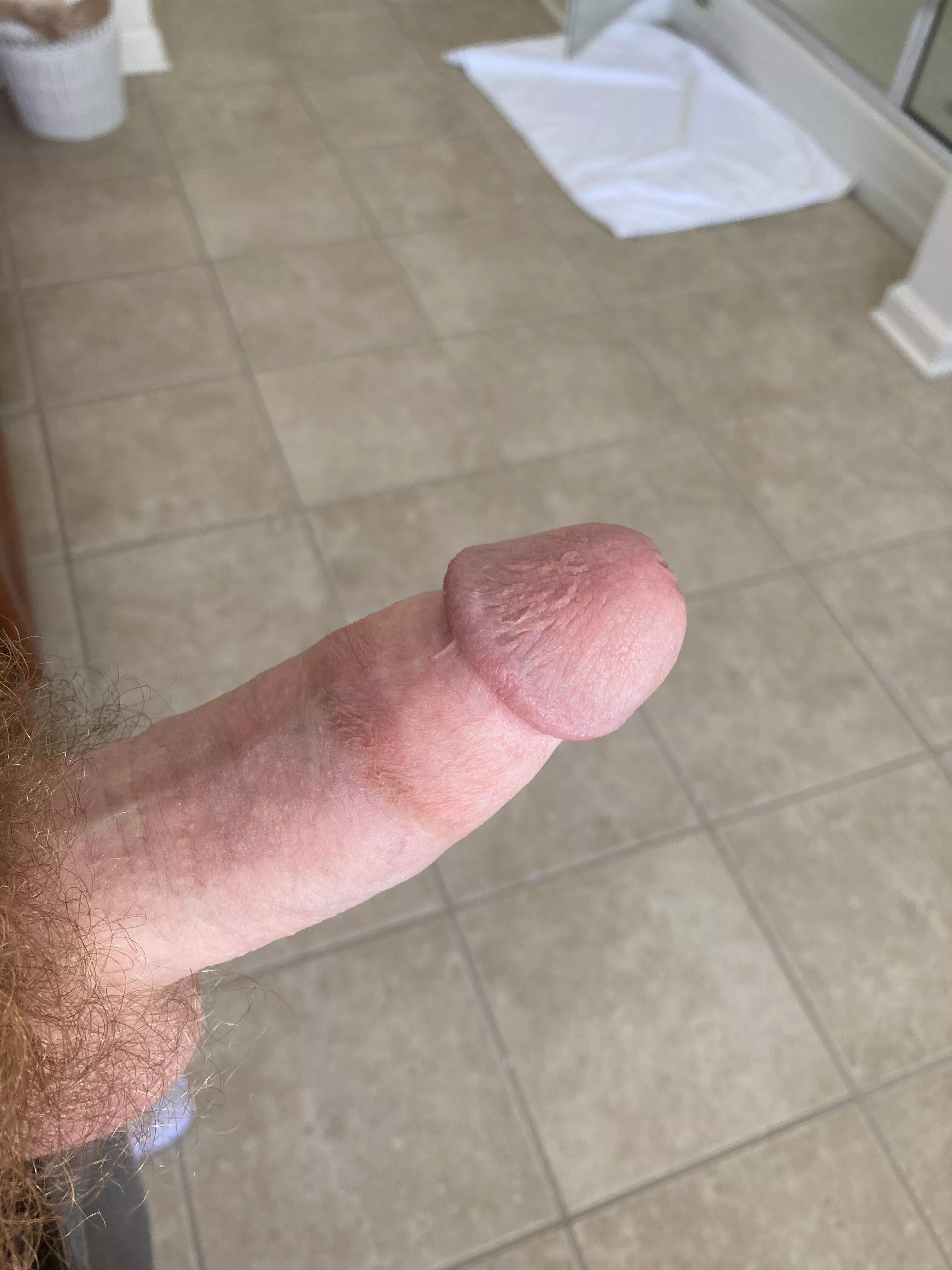 1-10? dms open