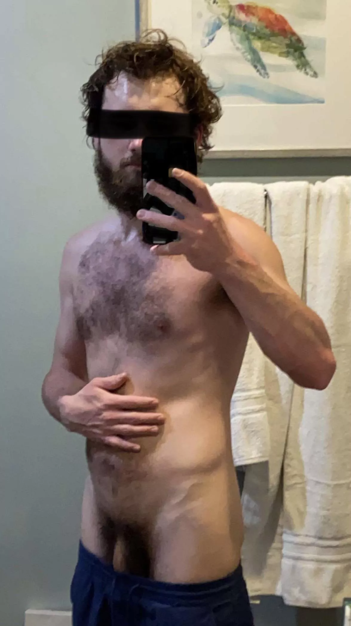 [20] Am I extra hairy for my age or is this normal?
