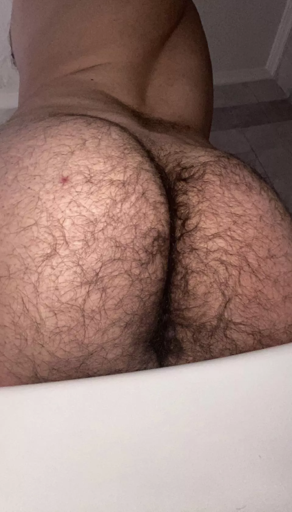 25m Pms Open Nudes Hairymanass Nude Pics Org
