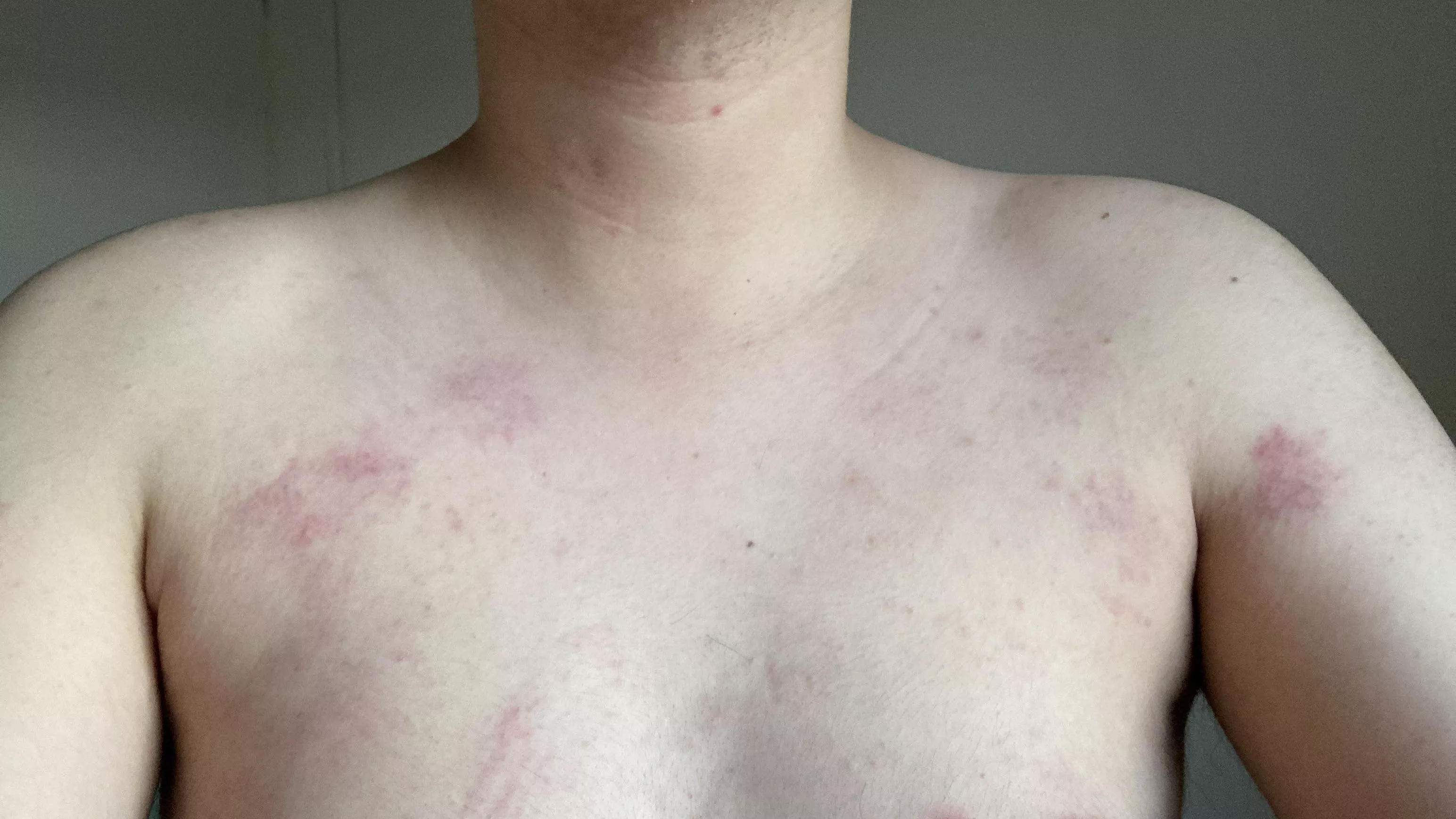 27 [M4M] Had Bruises from Sex with Tricycle Driver