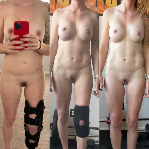 A different OnOff today. Broke my leg and here is my progress to being brace free!! (F33)