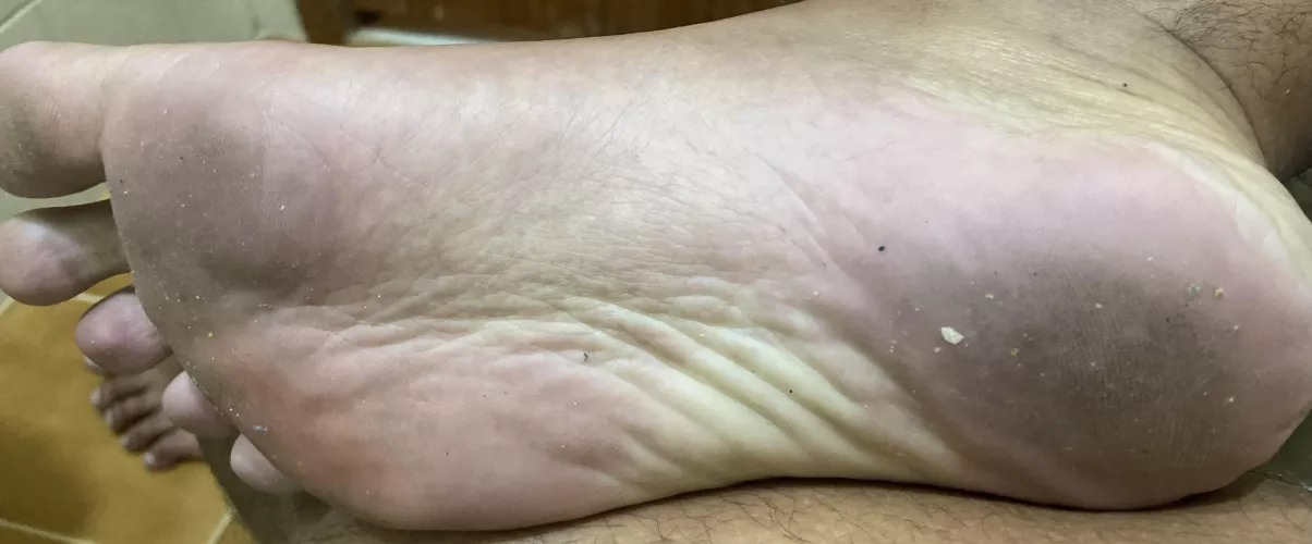 After 24 hours barefoot, dirty enough? If you want to lick or come on those dirty soles, you can π