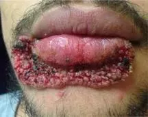 Always use clean tools! Credit to r/medicalgore, for some reason I couldn't xpost. Always use clean tools! Credit to r/medicalgore, for some reason I couldn't xpost.