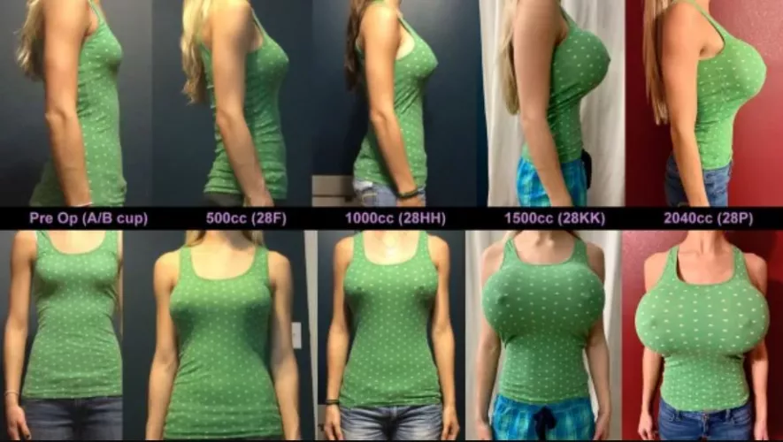 Amazing Transformation