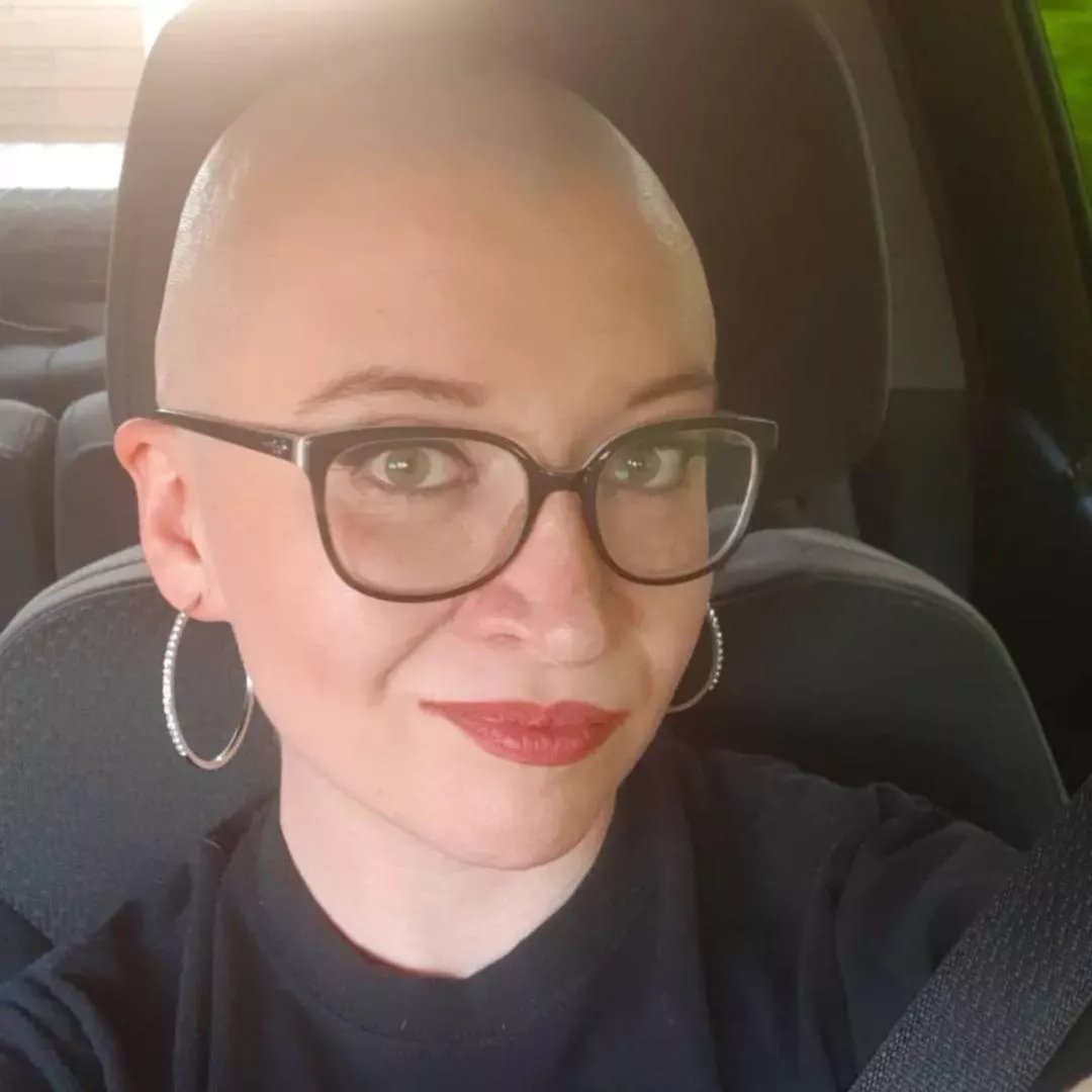 Anyone like bald girls? 🤔 HMU for customs 👀