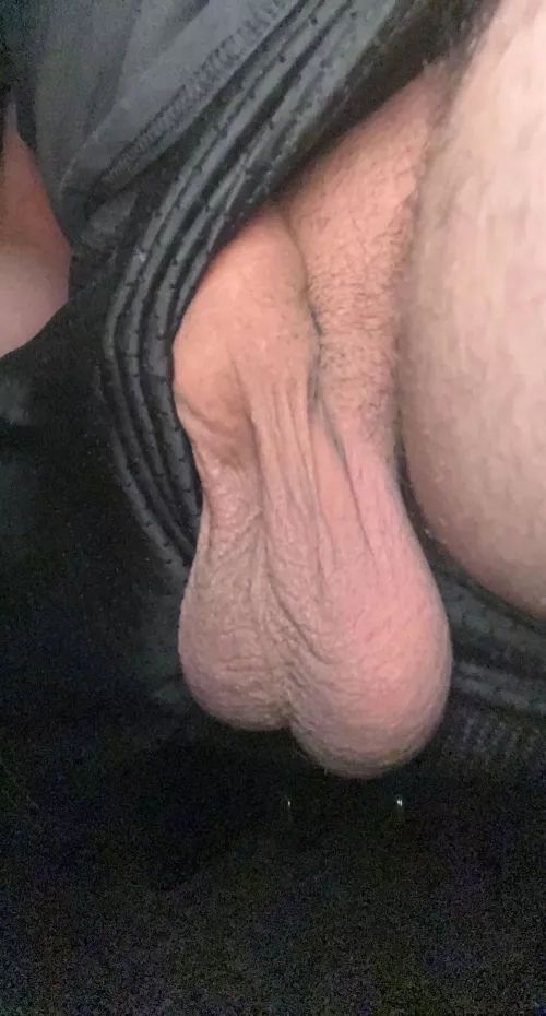 Anyone want to drain them