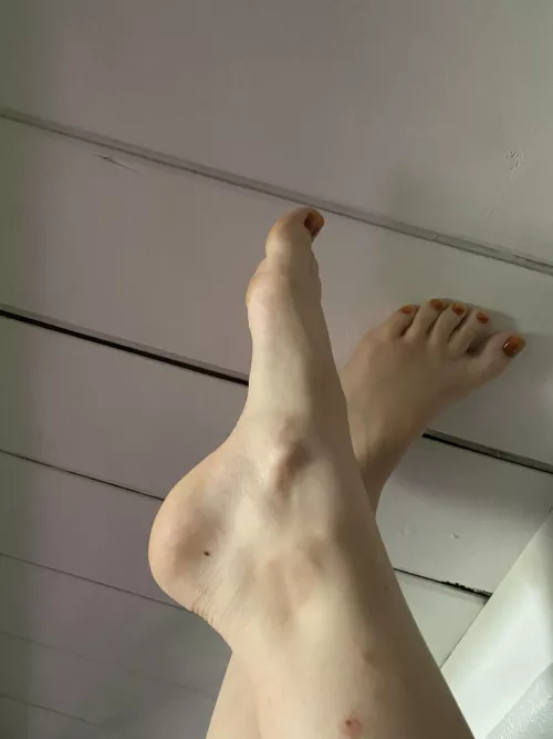 Are the Extra bones in my feet sexy? Genuine curiosity?