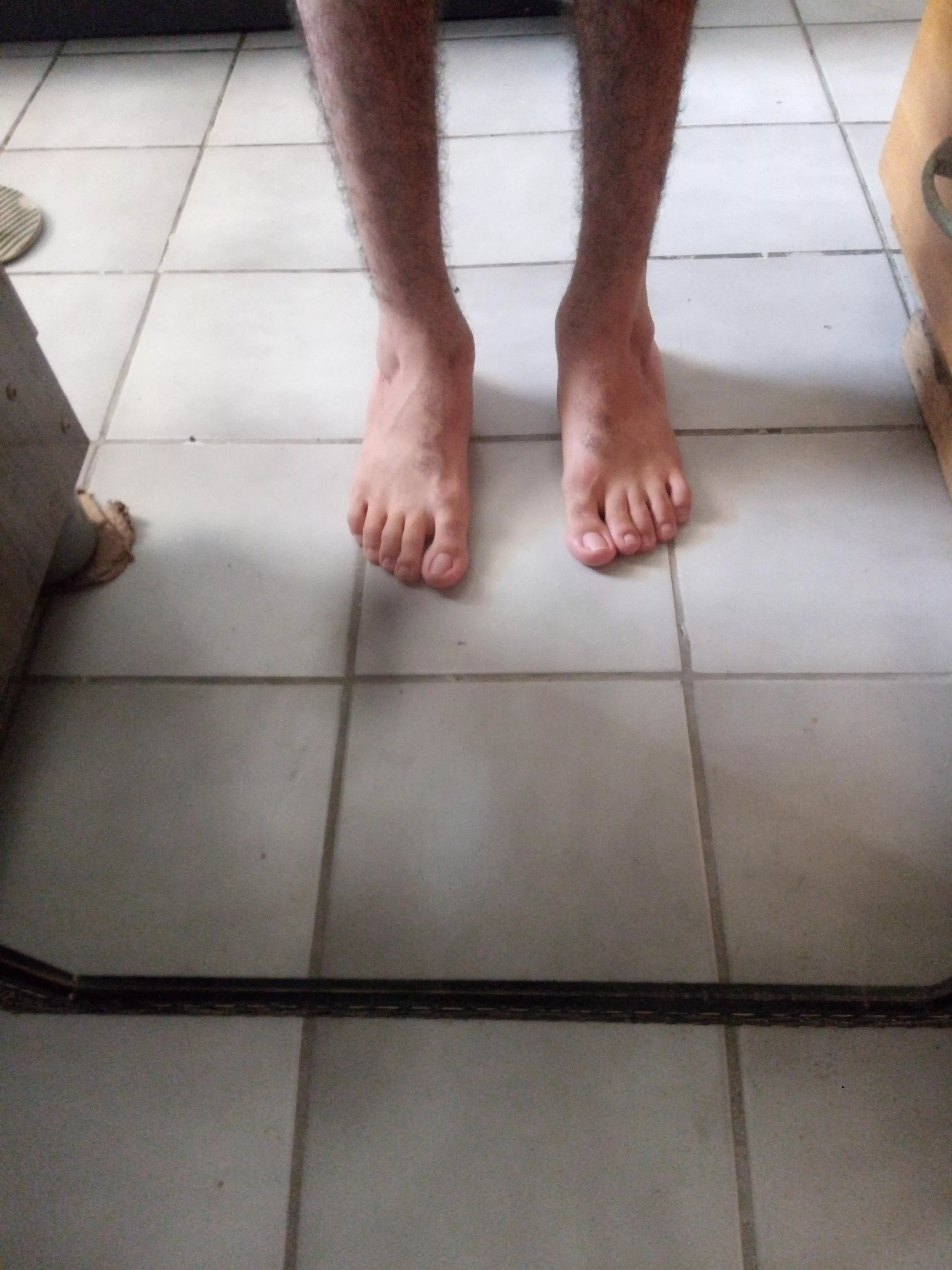 Are there people who have fetish for deformed feet? So I could make money off the part of my body i hate the most 🤷