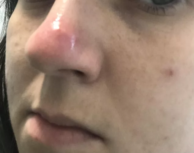 At what point do I say no bueno and go to a doctor