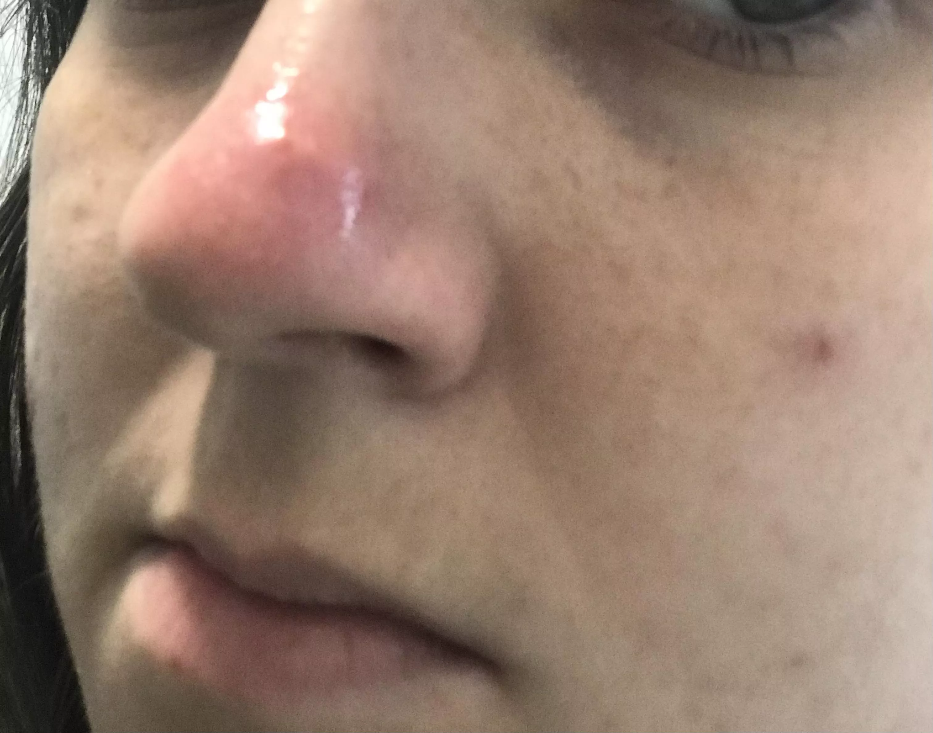 At what point do I say no bueno and go to a doctor