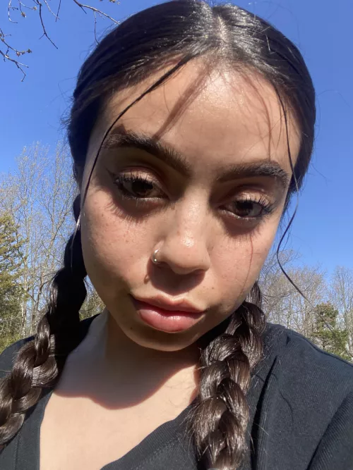 can you count my freckles?