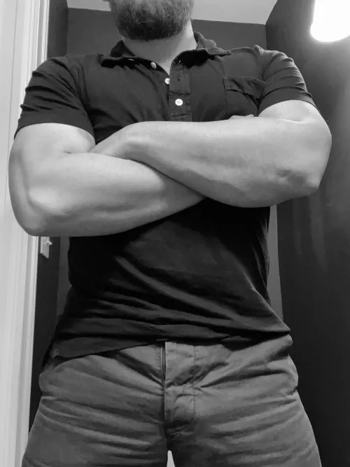 Can you tell me how I got that bruise on my arm?