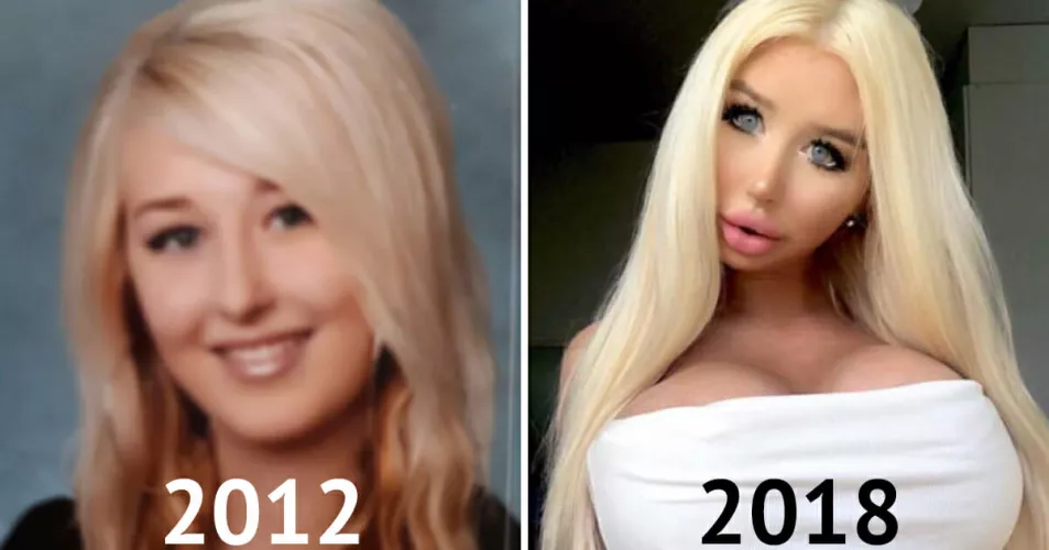 Changes