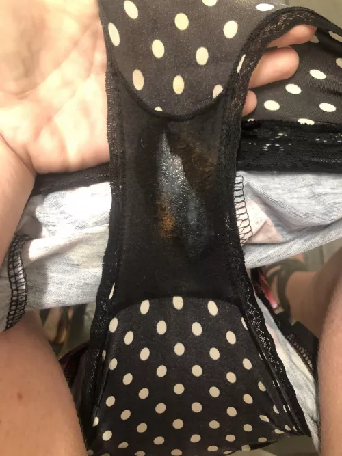 Day one with some prior discoloration due to ph