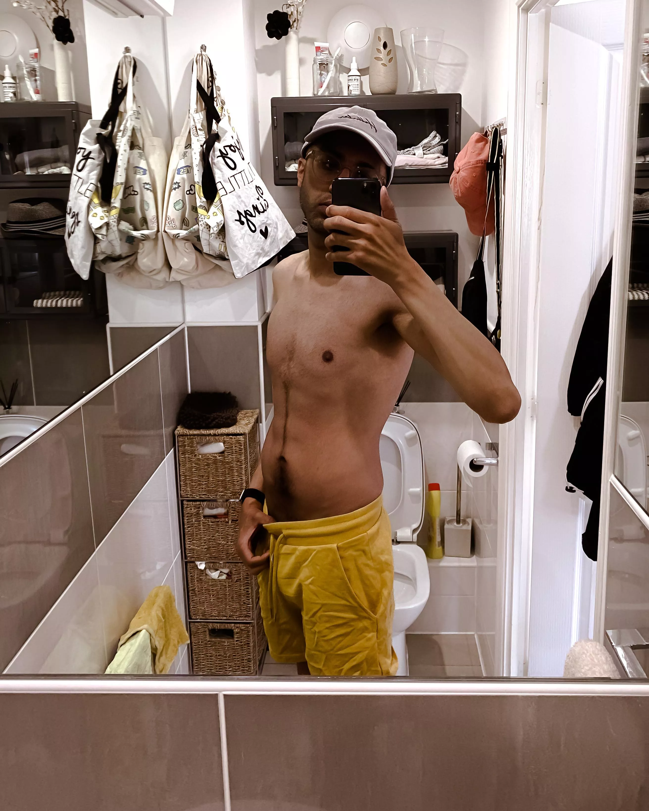 Did the whole sunbathing thing. Maybe a touch bit red 🫠