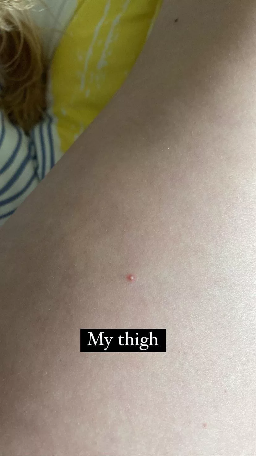 Do I pop it or leave it?