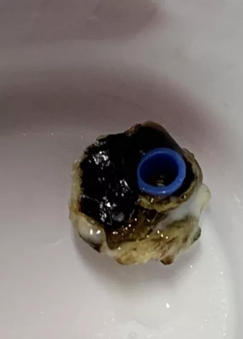 Ear tube fell out after 6 months. I can hear again.