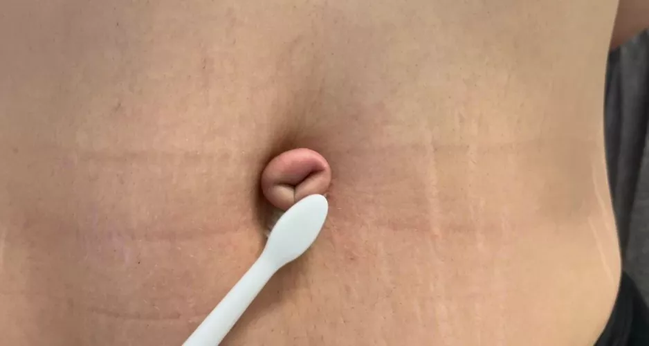 Electric toothbrush on my tied outie