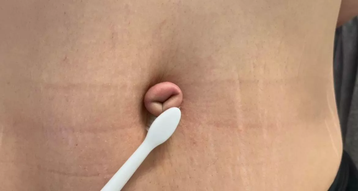 Electric toothbrush on my tied outie