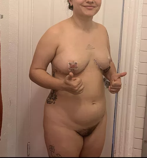 f, 26yo, 152 lbs, 5’0”. 2 days after breast reduction surgery. it hurt too much to relax my shoulders back, stand up straight, do all the things I do to feel attractive and comfortable. and yet, I felt SO much more like myself, like I had the body I