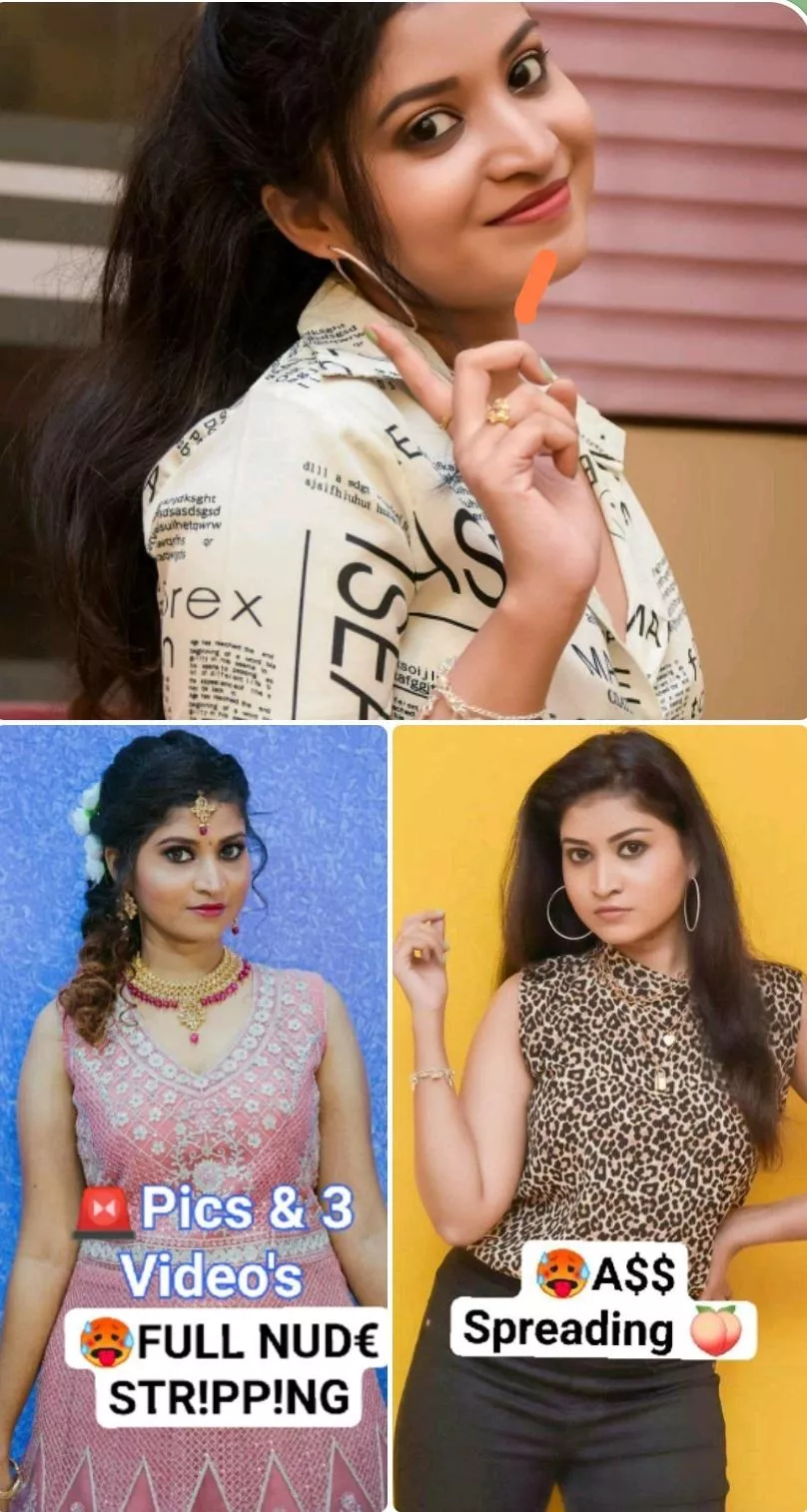 🔴FAMOUS INSTA MODEL KOMMAL💃 🥵OnlyFans Exclusive Full NUD€ Str!pping ,Closeup Shots & A$$ Spreading 🍑 Don't Miss😍🔥 ━━━━━━━━━━━━━━━━━━━━ ⬇️ Kommal_Pics & 3Video's ⬇️