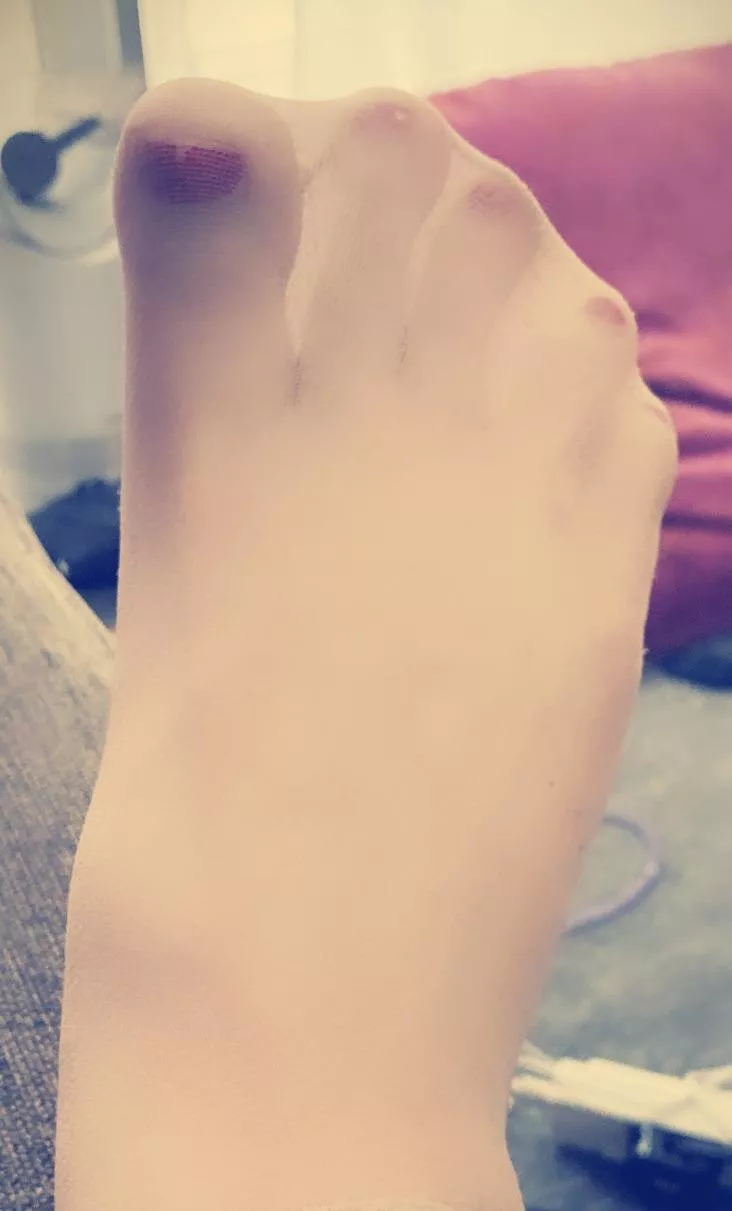 Fighting to break free 😈