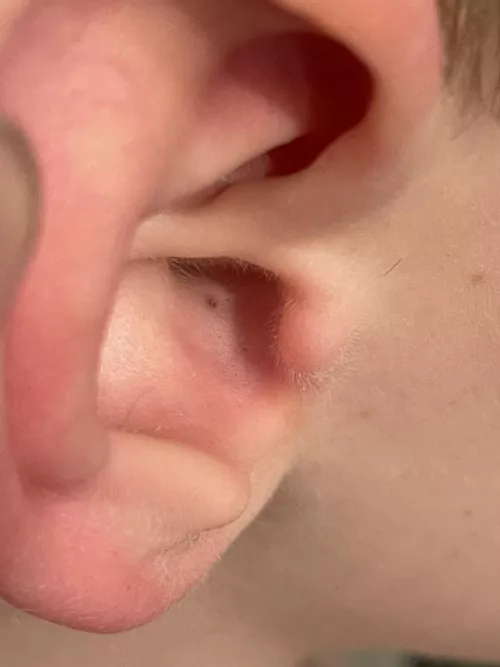 Forbidden pop in my little dudes ear