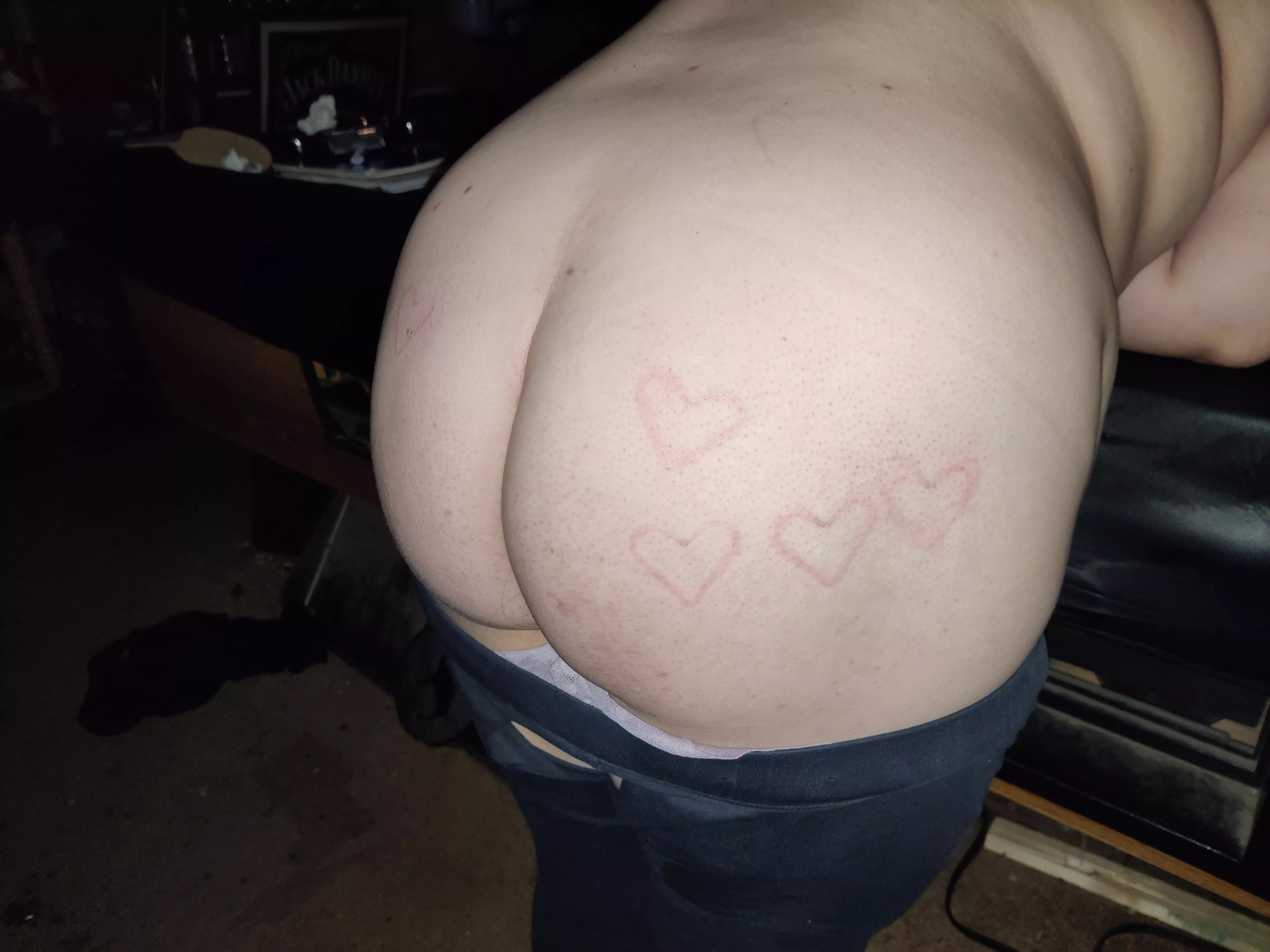 Foxo got some new burns for her special day