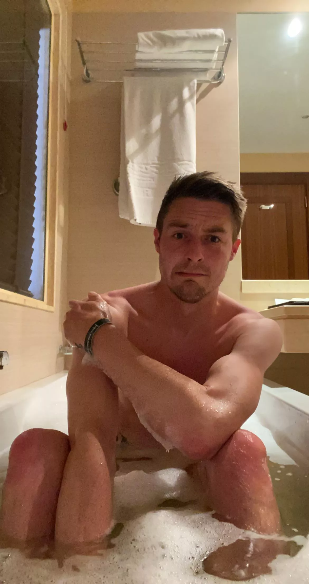 Got a bit sunburnt yesterday ☀️