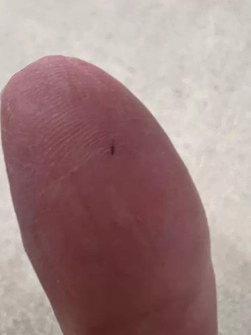 Got a sliver; no tweezers = torture!