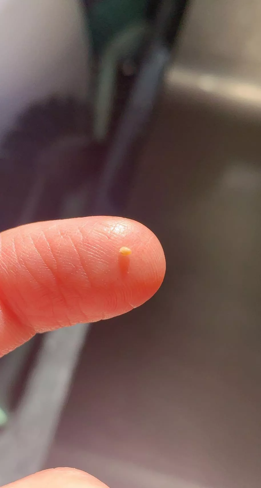 Got this big ass egg pulled out of my ear Got this big ass egg pulled out of my ear
