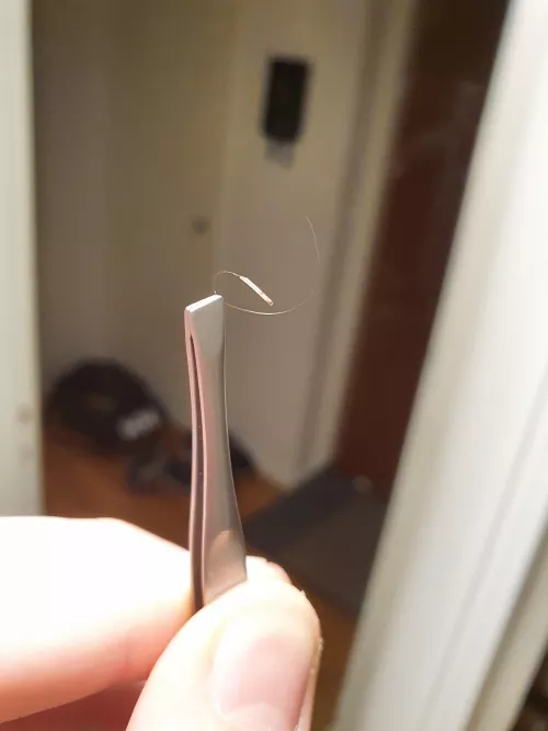 Had a few of these follicles 🤨 they always catch me off guard