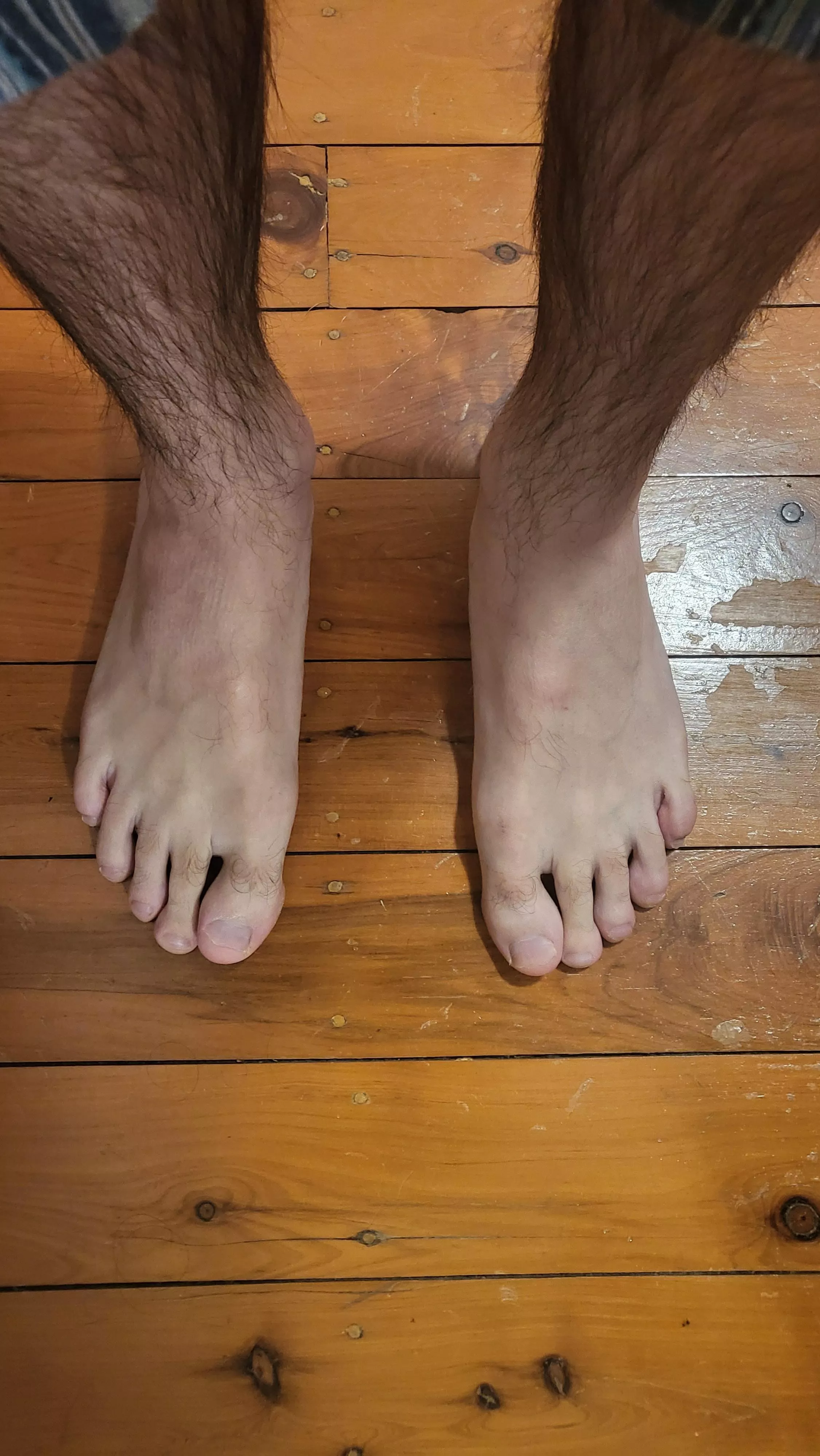 Hairy feet - message me