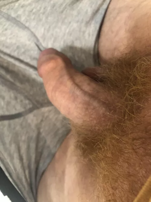 Hairy Ginger