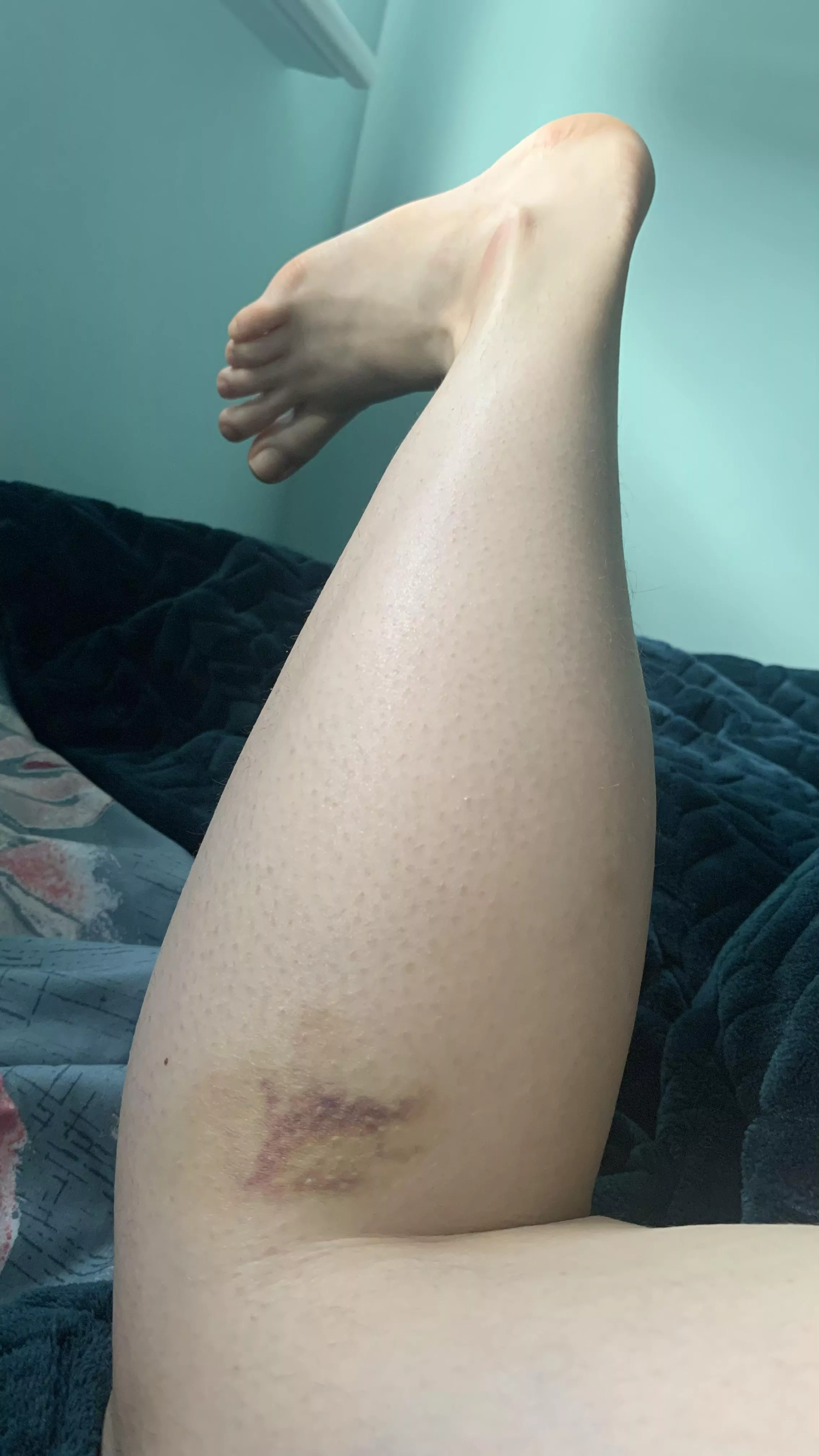 Hello dear xx😘🥺