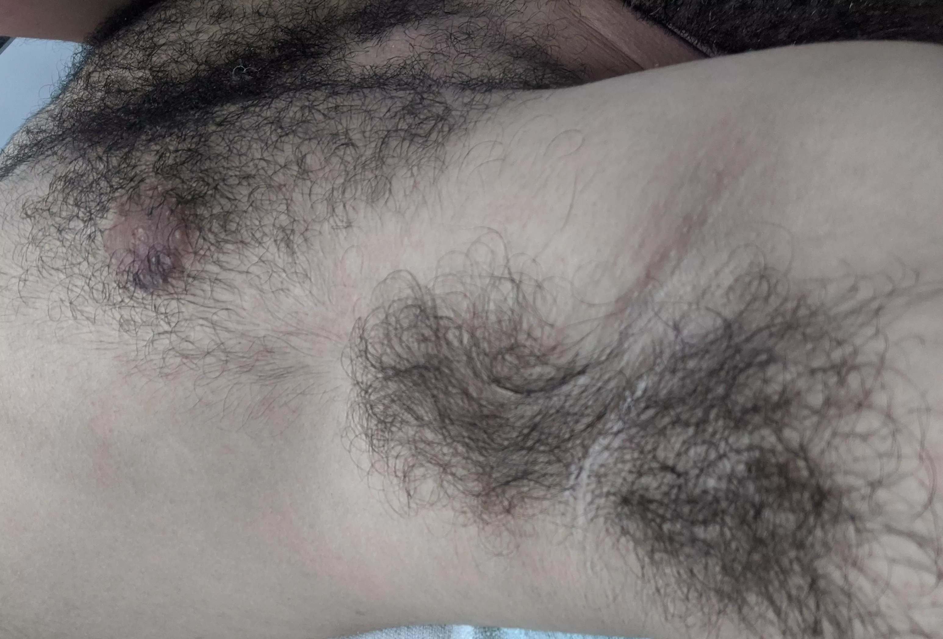 here's a close up of what used to be my hairy pits!