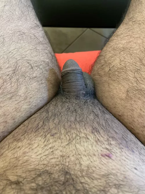 How bad is it? 🙈[34]