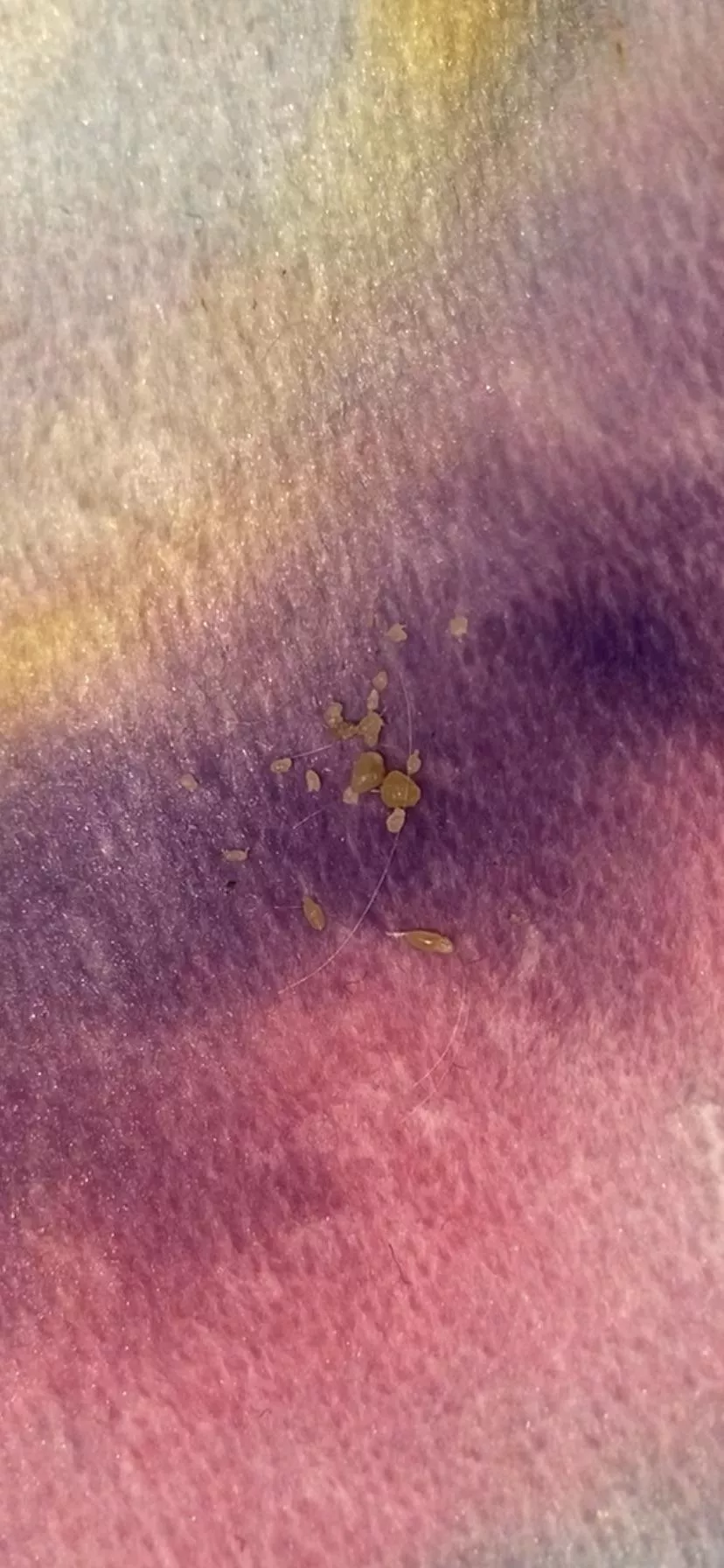 I call these ‘skin seeds’