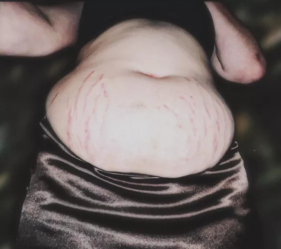 i haven't gained weight THAT quickly, have i? surely stretch marks like this are just from a little water weight...