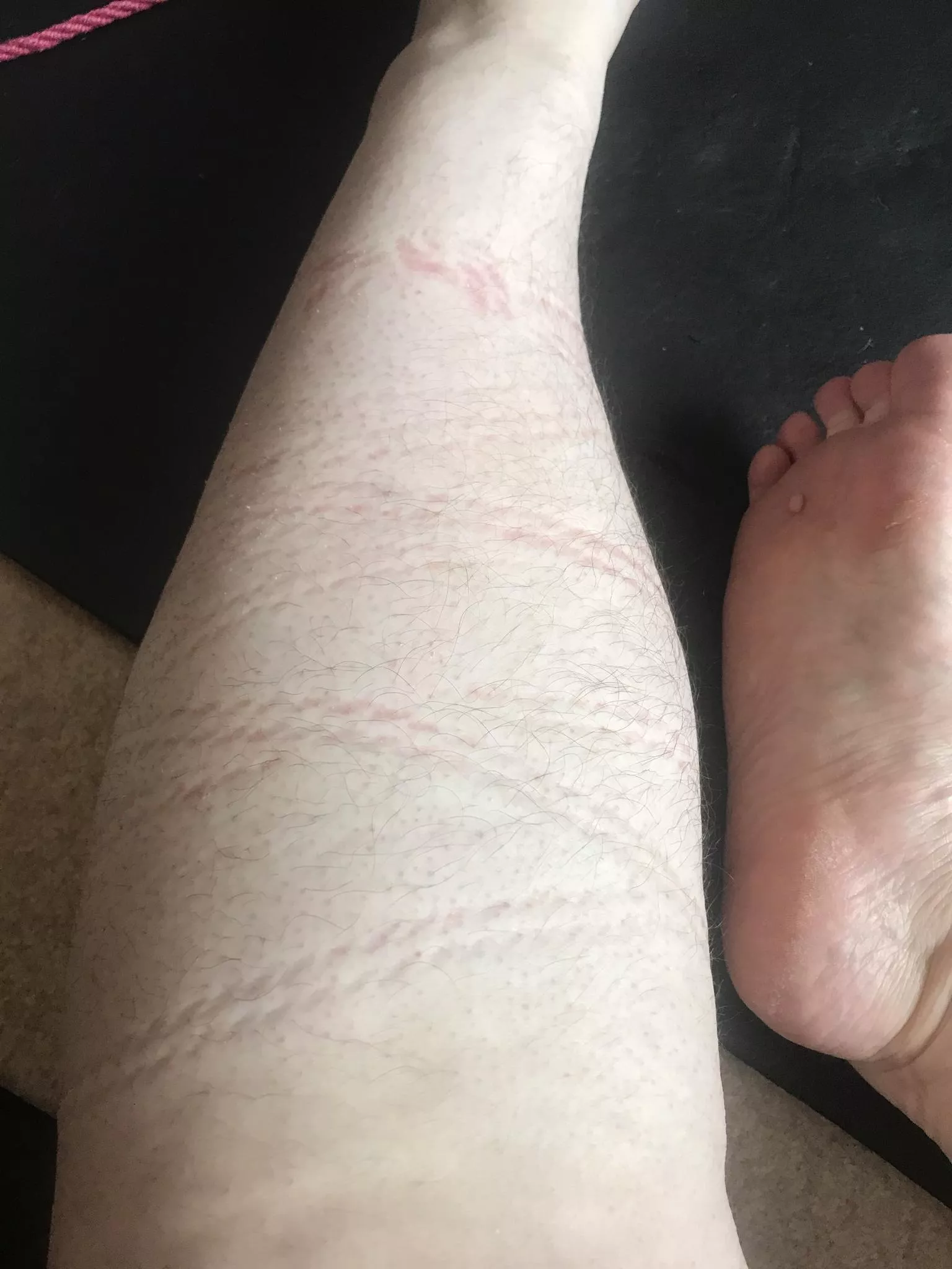 I love the rope marks after I've been tied!