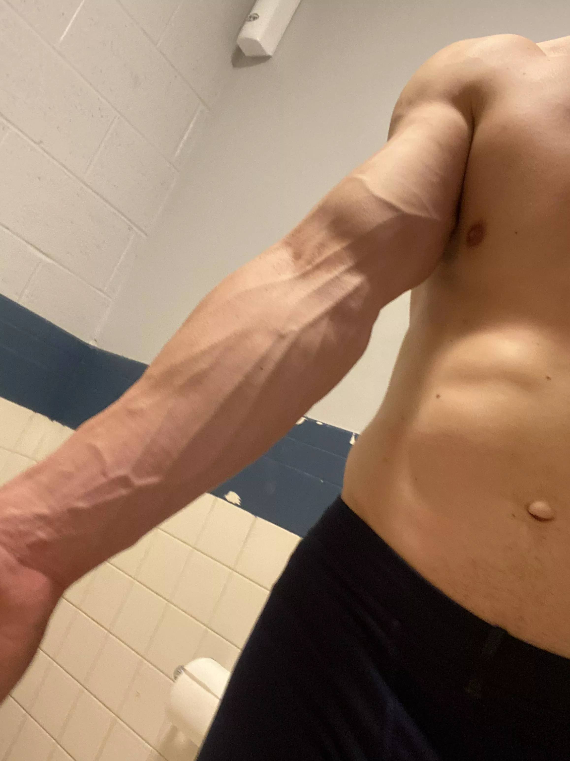 I once donated blood and the nurse missed my vein… How??