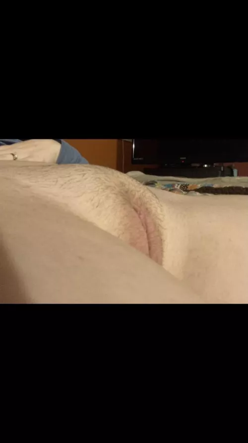 I pull my pants down & you see this, what do you do?