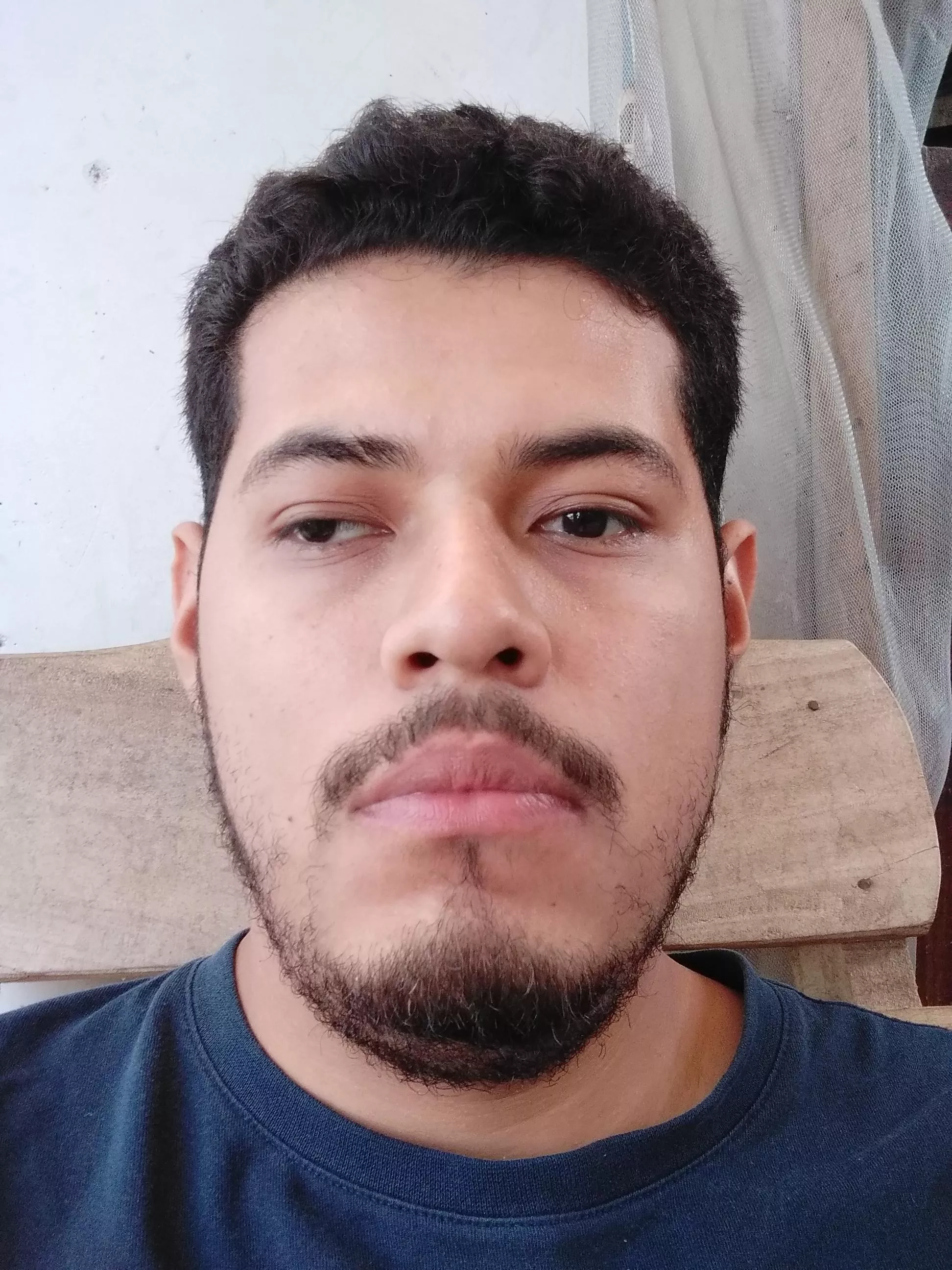 I used to dislike my lazy eye, now I embrace it as something that makes me different. What do you think?