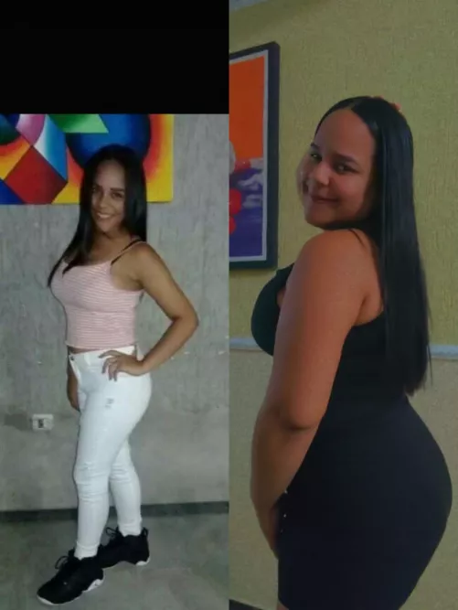 if every more surprised with my before and after I love it, thanks to all the feeders 🙏🏼🤩😍🤩❤️🤩