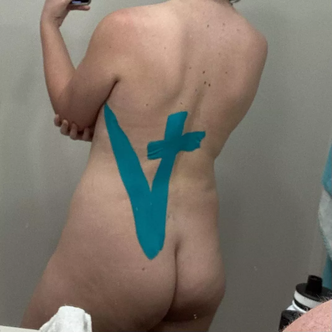 Ignore the KT tape lol 280lbs to 208. 5’11” 21yo female. Lost the 80ish pounds since this time last year.