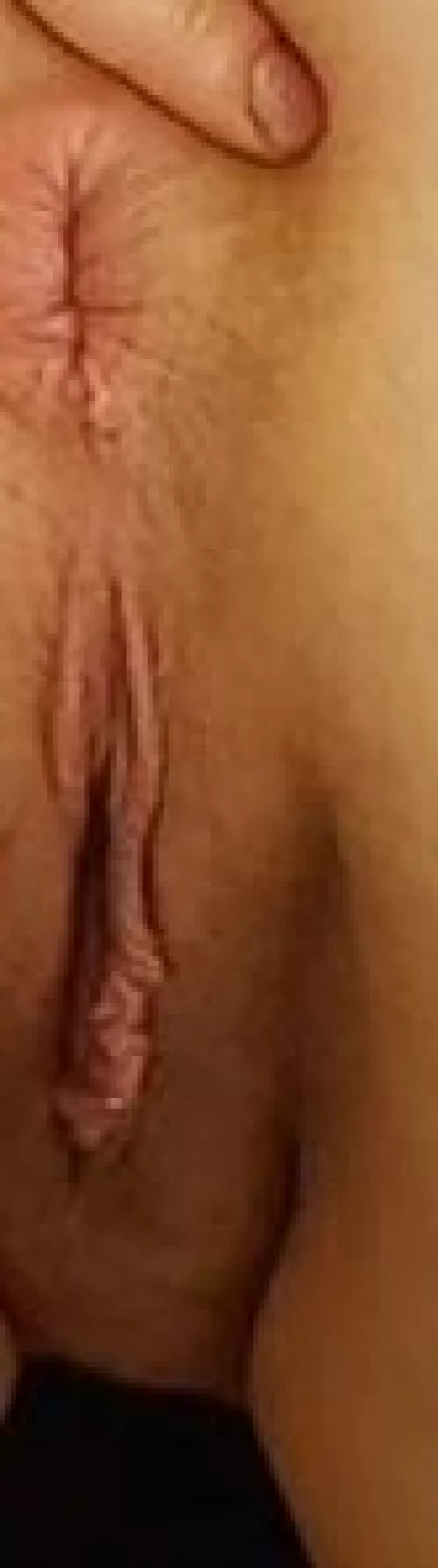 Imagine this: I'm a stranger and you get a secret look at my clearly altered butthole. What are you doing first?