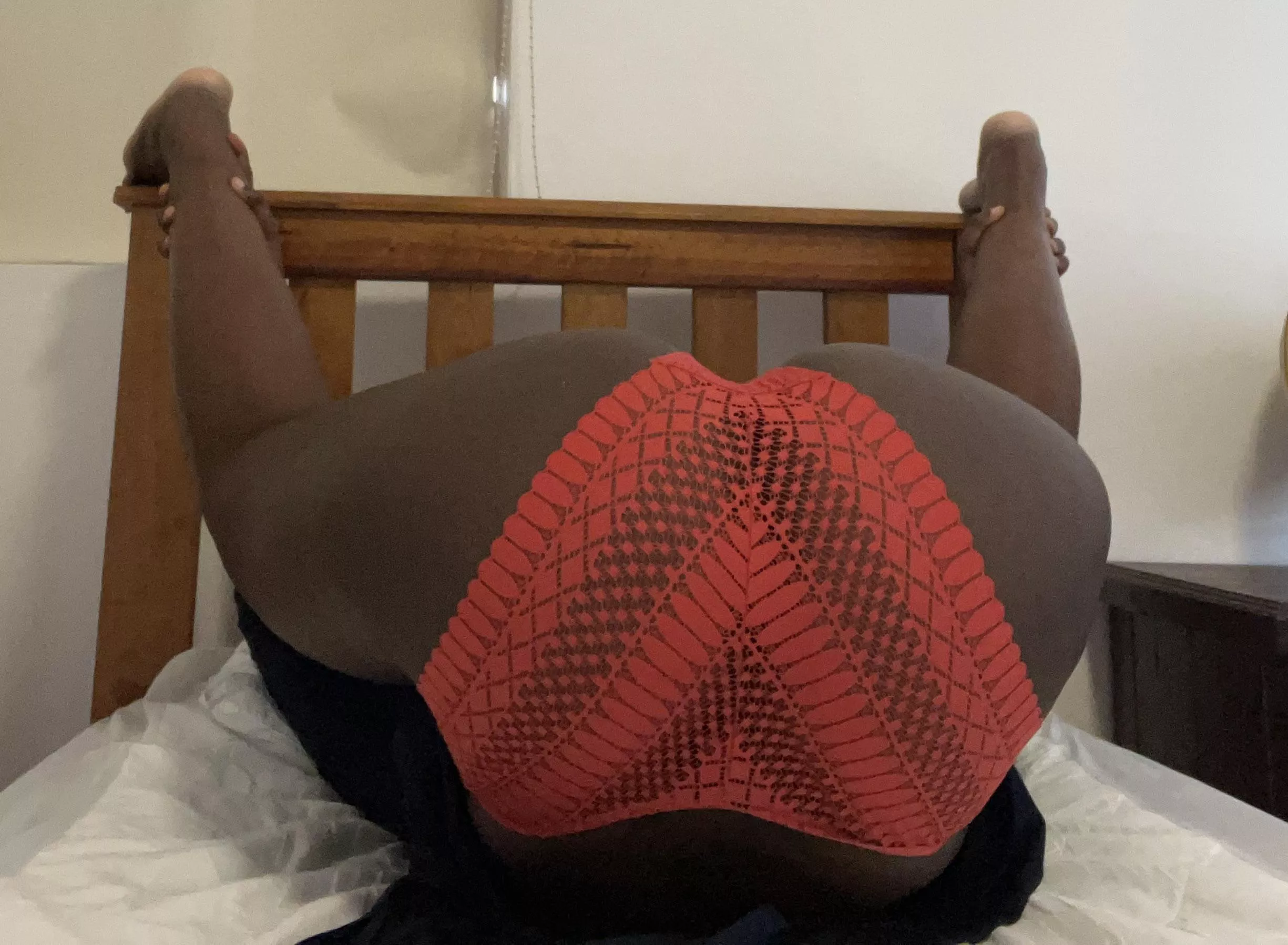 Is 135° considered lithotomy?