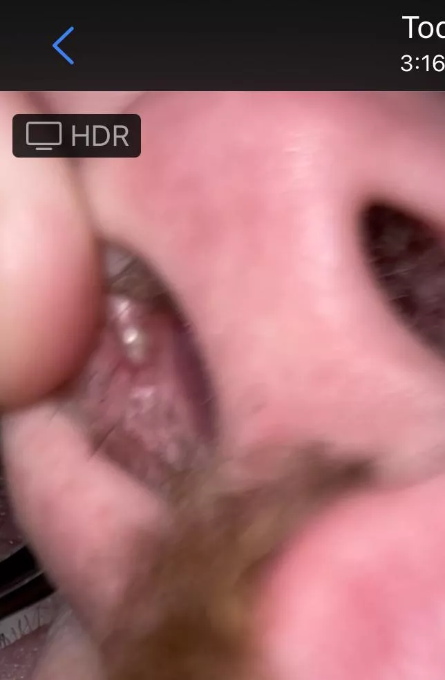 It'll be impossible to film without help, but know that this is the most annoying thing I've ever dealt with It'll be impossible to film without help, but know that this is the most annoying thing I've ever dealt with