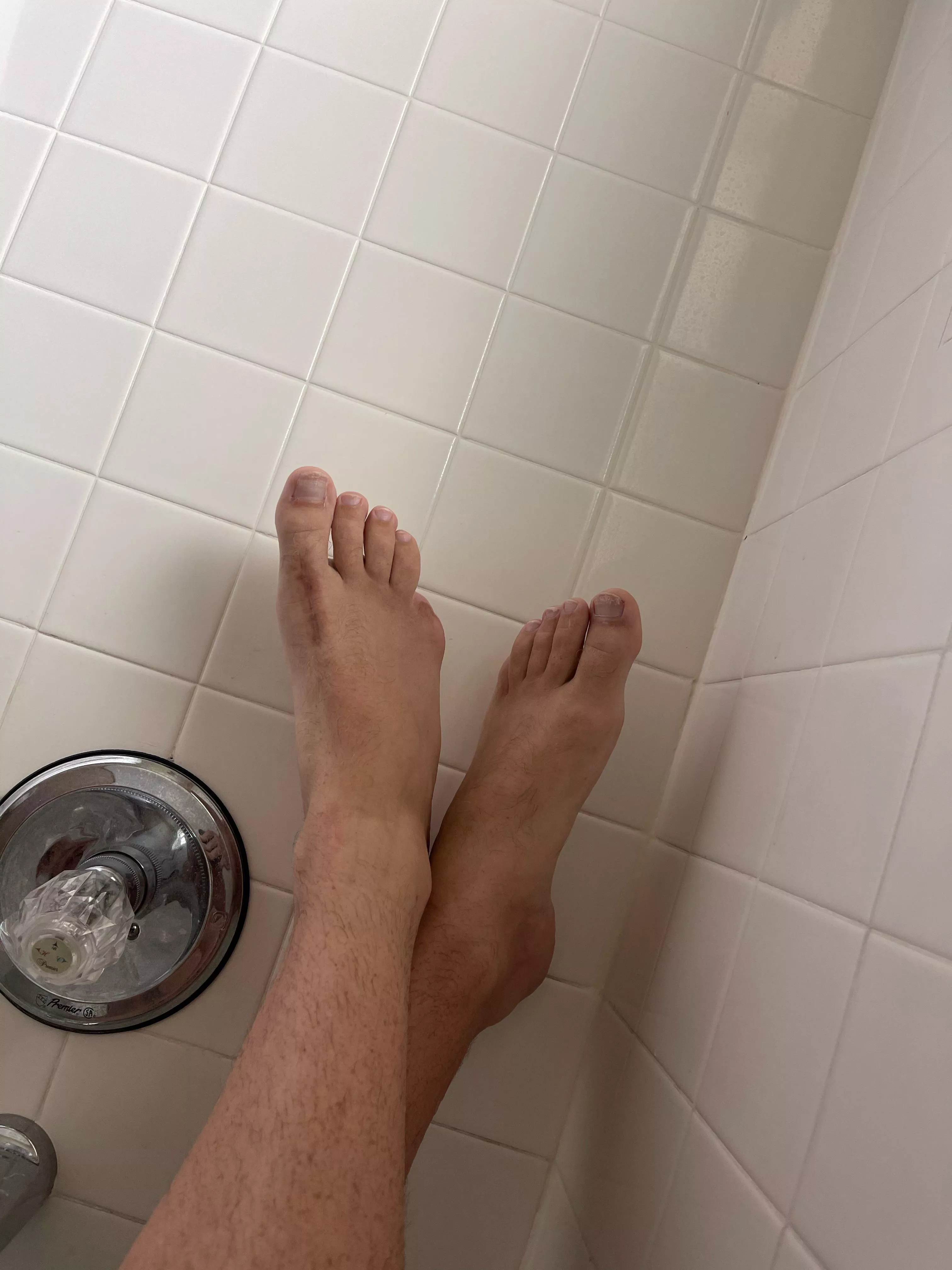 It’s my cake day, so here are my nine toes